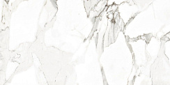 122